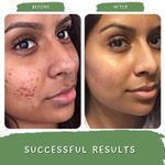 Buy Mystiq Living Specials - Green Coffee Blemish Clear - Face Scrub | De Tan, Dark Spot Removal , Anti Pigmentation, Skin Brightening & Glowing Skin | With Oatmeal & Turmeric | Ayurvedic Formulation - 100 GM - Purplle