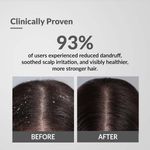 Buy Fixderma Bioteez-S Natural Conditioner For Dry Hair With 1% W/W, Salicylic Acid|Reduces Dandruff, Soothes Itchy Scalp|Reduces Hair Frizz, Paraben & Sulphate Free, Makes Shiny & Soft Hair 75 ml, (Pack of 1) - Purplle