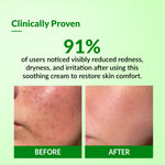 Buy Fixderma Cleovera Cream, Skin Moisturizer With Aloe Vera, Reduces Inflammation & Redness, Soothing & Hydrating Cream, Post Surgery, After Shaving & Waxing Cream, Paraben Free- 60gm - Purplle