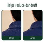 Buy Neem Ayu Anti Dandruff Ayurvedic Capsules | Made with Ayurvedic ingredients | Anantmool, Haridra, Manjistha, Neem, Bakuchi, Bhringraja, Chirayata, Katuki | Helps in Reducing Dandruff | 60 N - Purplle