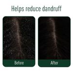 Buy Neem Ayu Anti Dandruff Ayurvedic Capsules | Made with Ayurvedic ingredients | Anantmool, Haridra, Manjistha, Neem, Bakuchi, Bhringraja, Chirayata, Katuki | Helps in Reducing Dandruff | 60 N - Purplle