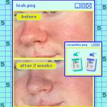 Buy Revolution Skincare Ceramides Hydrating Cleanser 236 ML - Purplle