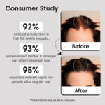 Buy Aravi Organic Hair Growth Serum with Redensyl, Anagain & Procapil | Reduces Hair Fall, Boosts Hair Density & Strength | Dermatologist Tested, Lightweight & Non-Greasy | For Men & Women – 30 ml - Purplle