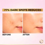 Buy L'Oreal Paris Glycolic Bright 8% [Melasyl + Niacinamide] Face Serum for Brightening Dark Spots - 15 ml - Purplle