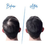 Buy Clensta Lock In Hair Growth Foam|5% Minoxidil| Hair Growth & Regrowth| Reduces Hair fall| For Men & Women - Purplle