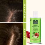 Buy Organic Harvest Anti Dandruff Shampoo with Tea Tree and Apple Cider Vinegar for Women & Men | For All Type Hair | Free from Chemicals, Mineral Oils, Alcohol (500 ml) - Purplle