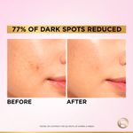 Buy L'Oreal Paris Glycolic Bright 8% [Melasyl + Niacinamide] Face Serum for Brightening Dark Spots - 15 ml - Purplle