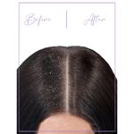 Buy SANFE Selfy Anti-Dandruff Hair Comb with 3-in-1 Function to Get Dandruff Free, Exfoliated & Healthy Hair. Comes with Keratin Infused Ceramic Coated Bristles & Stainless Steel Rounded Tips to Straighten, Detangle & Style Hair within 4mins. - 1 Pc - Purplle