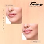 Buy Freshistry Natural Lip Plumper For Women | Peppermint & Cinnamon Oil | Fuller Lips, Dryness, Moisturization & Nourishment |10 ML - Purplle