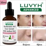 Buy Luvyh Aloe Vera Cold Cream and Winter Cream for Women and Men (100g) Organic Non-Toxic AloeVera for Acne, for Scars, Glowing & Radiant Skin , Oily and All Skin Types No Parabens, No Mineral Oil, No Sulphate, No Silicone - Purplle