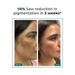 Buy Conscious Chemist 5% Niacinamide Serum | 30 ml | Serum for Pigmentation and Dark spot, Alpha Arbutin & Tranexamic Acid Face Serum, For Acne Scars & Uneven Skin, Face Serum for Men & Women - Purplle