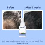 Buy WishCare Hair Growth Serum Concentrate -3%Resdensyl, 4%Anagain, 2%Baicapil, Rosemary, Caffeine, Biotin,Plant Keratin & Rice Water 30 ml - Purplle