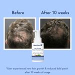 Buy WishCare Hair Growth Serum Concentrate -3%Resdensyl, 4%Anagain, 2%Baicapil, Rosemary, Caffeine, Biotin,Plant Keratin & Rice Water 30 ml - Purplle