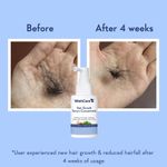 Buy WishCare Hair Growth Serum Concentrate -3%Resdensyl, 4%Anagain, 2%Baicapil, Rosemary, Caffeine, Biotin,Plant Keratin & Rice Water 30 ml - Purplle