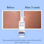 Buy WishCare AHA + BHA Body Lotion for DeTan-10% AHA + 1% Salicylic Acid- Niacinamide, Grapefruit & Blueberry - 200 ml - Purplle