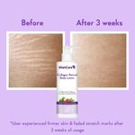 Buy WishCare Collagen Retinol Body Lotion - 1% Retinol, Plant Collagen, Ceramide, Avocado & Rosehip - 200 ml - Purplle