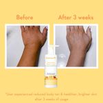 Buy WishCare SPF50 Sunscreen Body Lotion - Broad Spectrum UVA & UVB Protection-For Everyday Sun Protection - 200 ml - Purplle