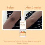 Buy WishCare Multi-Vitamin Brightening Body Lotion - 5% Vitamin C,5% Niacinamide(B3), D-Panthenol(B5), Vitamin-E, Hyaluronic Acid & Ceramide - 200 ml - Purplle