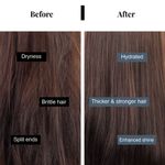 Buy Bare Anatomy Anti-Hair Fall Serum | Provides 5X Hair Fall Control | All Hair Types | 50 ml - Purplle