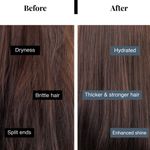 Buy Bare Anatomy Anti Hair-Fall Shampoo with Adenosine & Peptides| Sulphate & Paraben Free (250 ml) - Purplle