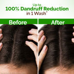 Buy Mamaearth Lemon Anti-Dandruff Shampoo with Lemon & Aloe Vera for up to 100% Dandruff & Itch-free Scalp- 250 ml - Purplle