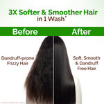 Buy Mamaearth Lemon Anti-Dandruff Conditioner with Lemon & Aloe Vera for Soft & Smooth Hair (250 ml) - Purplle