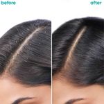 Buy Biolage Professional Scalppure Anti-Dandruff Hair Serum, Removes Visible Flakes from 1st Use, Enriched with Bergamot, Cruelty-Free, 100 ml - Purplle