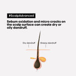 Buy L'Oreal Professionnel Scalp Advanced Anti-Dandruff Dermo-Clarifier Shampoo 300 ml | Removes Dandruff - Purplle