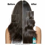 Buy L'Oreal Professionnel Scalp Advanced Anti-Discomfort Dermo-Regulator Shampoo 300 ml for Sensitive Scalp - Purplle