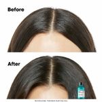 Buy L'Oreal Professionnel Scalp Advanced Anti-Discomfort Dermo-Regulator Shampoo 300 ml for Sensitive Scalp - Purplle