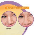 Buy Dr.Rashel Vitamin C Nose Pore Strips Deep Cleansing (10 Strips) - Purplle