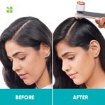 Buy Biolage Scalppure Shampoo + Conditioner(200ml + 98g)|For Dandruff Control|For Men & Women - Purplle
