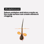 Buy L'Oreal Professionnel Scalp Advanced Anti-Oiliness Dermo-Purifier Shampoo + Scalp Advanced Anti-Oiliness 2-In-1 Deep Purifier Clay(300ml+250gms) - Purplle