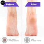 Buy MeSkin Pumice Stone For Exfoliation & Callus Free Feet, Assorted Shape & Colors (1 Pcs) - Purplle