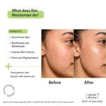 Buy Nature Derma 1% Natural Biome-Boost™ Moisturizer with Subligana to Reduce Acne and Blemishes| For Soothed, Strengthened Skin | 50ml - Dermatologically Tested - Purplle