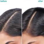 Buy Biolage Professional Scalppure Anti-Dandruff Shampoo & Conditioner Combo, Removes Visible Flakes from 1st Use, With Bergamot, Cruelty-Free,200ml + 98g - Purplle