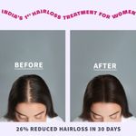 Buy Anveya Roots Ban the Fall Hair Oil-in Serum, 120 ml | For Hair Fall in Women | Prevents Hair Thinning & Removes Scalp Infection | With Onion Oil & Chamomile Oil - Purplle