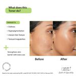 Buy Nature Derma Niacinamide Toner Essence with Natural Biome-Boosta„¢Solution For Soothed, Strengthened Skin 100ml - Purplle