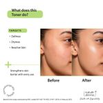 Buy Nature Derma Hyaluronic Acid Toner Essence with Natural Biome-Boosta„¢ Solution for Hydrated, Strengthened Skin 100ml - Purplle
