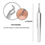 Buy Bronson Professional Acne and Black Head Remover Tool Set with Storage Box 5 pcs - Purplle