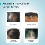 Buy Pilgrim Redensyl + Anagain Advanced Hair Growth Serum with Green Tea |All Hair Types | For Women & Men | Discover Thick and Dense Hair | Vegan (50 ml) - Purplle