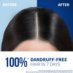 Buy St.Botanica Anti-dandruff Pre-biotic Conditioner 200 ml | Fights Dryness, Frizz & Controls Dandruff - Purplle