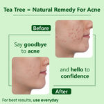 Buy Good Vibes Tea Tree Oil Control Light Gel Cream | Anti-Acne Hydrating Moisturizing | No Parabens No Sulphates No Mineral Oil (50 gm) - Purplle