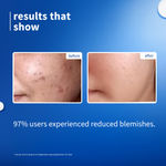 Buy Plum 10% Niacinamide Face Serum with Rice Water for Blemish-Free, Clear & Bright Skin (15 ml) - Purplle