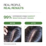 Buy Bare Anatomy Anti-Dandruff Shampoo - Strengthens Hair with Salicylic Acid & Biotin (250 ml) - Purplle