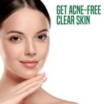Buy Nature's Essence Acne Magic Gel Face Wash with Tea Tree oil, 100ml - Purplle