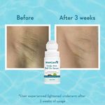 Buy WishCare Under Arm Roll On Serum for Under Arm Lightening, Treats Pigmentation & Controls Odour- 5% AHA, 3% Kojic Acid, Hyaluronic Acid, Acid Licorice & CICA- Aqua Fresh - 50 ml - Purplle