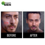 Buy Garnier Men Acno Fight Pimple Clearing Facewash, 150gm + Acno Fight Anti Pimple Moisturiser (Pack of 2) - Purplle