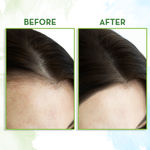 Buy Mamaearth Rosemary Hair Growth Oil with Rosemary & Methi Dana for Promoting Hair Growth - 100 ml - Purplle