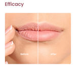 Buy Earth Rhythm Lip Care Kit pack of 4 | Lip Scrub, Lip Serum, Lip Balm & Lip Mask | Exfoliate, Hydrate, Nourish, Moisturize | For Men & Women - Purplle